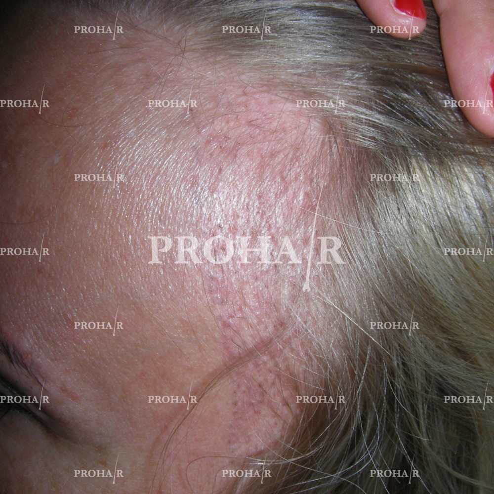 PROHAIR International Hair Transplant Klinika facility